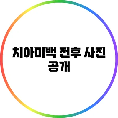 치아미백 전후 사진 공개
